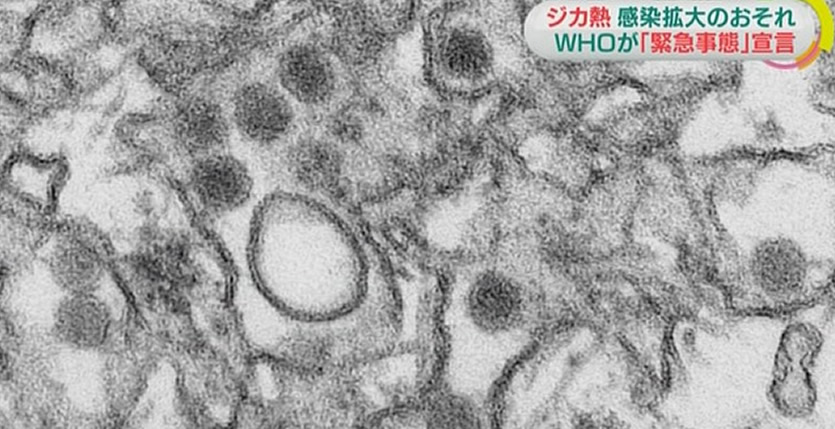 &nbspJapan urges doctors to report Zika patients