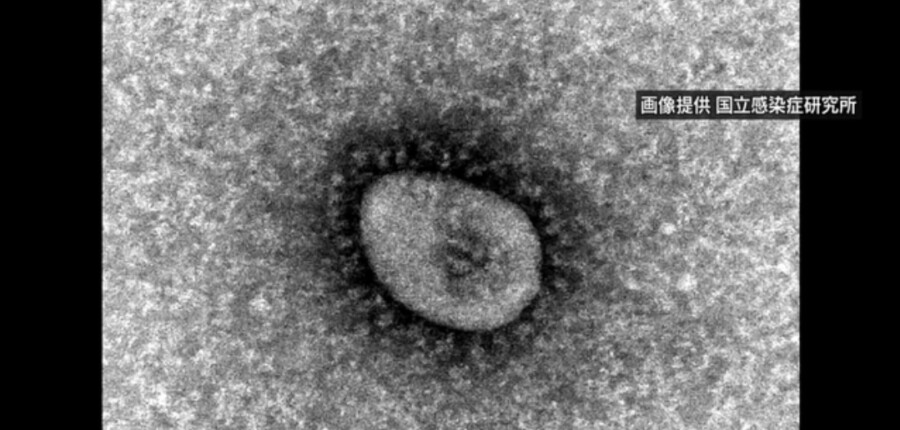 &nbspJapan nag-ulat ng 35,008 na bagong cases ng coronavirus nationwide, na may na 25 namatay