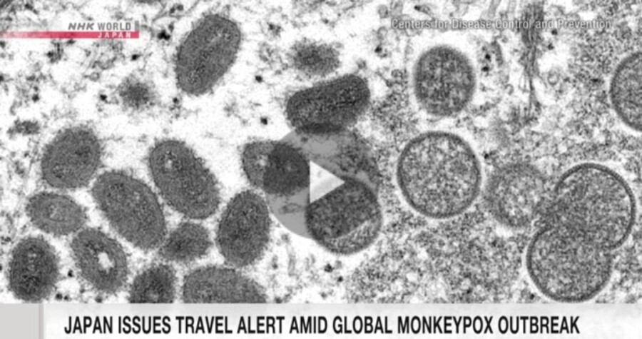 &nbspJapan nag issue ng level-one alert sa pagkalat globally ng monkeypox outbreak
